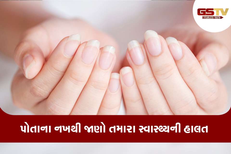 નખ